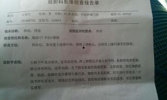 拿错癌症报告后,误拿癌症报告引发的医疗误会与反思